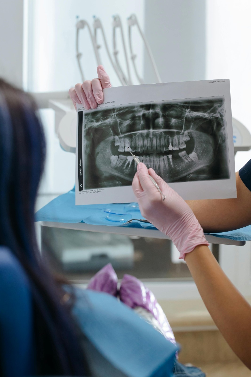 Expert Third Molar